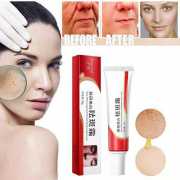 Wrinkle Dark Spots Witening Cream