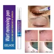 Wart Removing Skin Pen Gel