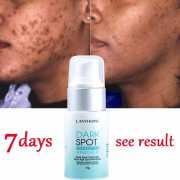 Dark Spot Cream Corrector Remover (30g)