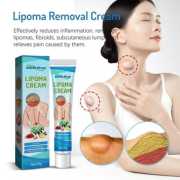 1 Pcs/Lipoma Removal Cream-লাইপোমা রিমুভাল ক্রিম