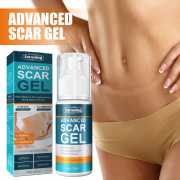 Jaysuing Scar Gel- স্ক্যাচ-দাগ দূরীকরণের